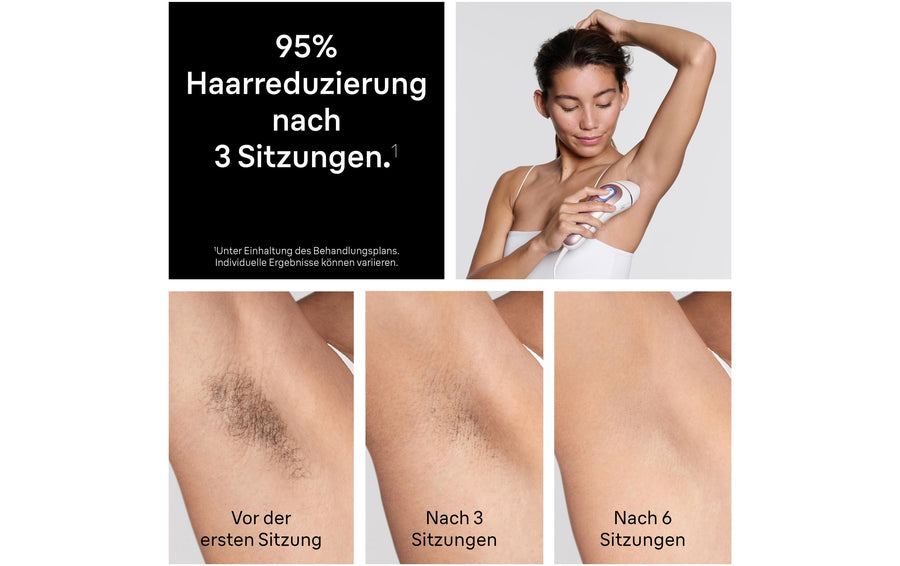 Braun IPL-Haarentferner Skin i-expert Pro PL7431 mit 4 Aufsätzen